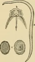 An illustration from The diseases of infancy and childhood : for the use of students and practitioners of medicine / by L. Emmett Holt with two hundred and forty-one illustrations, including eight coloured plates. (1908)
