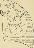 An illustration from The diseases of infancy and childhood : for the use of students and practitioners of medicine / by L. Emmett Holt with two hundred and forty-one illustrations, including eight coloured plates. (1908)