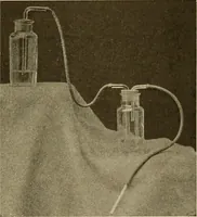 An illustration from The diseases of infancy and childhood : for the use of students and practitioners of medicine / by L. Emmett Holt with two hundred and forty-one illustrations, including eight coloured plates. (1908)