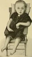An illustration from The diseases of infancy and childhood : for the use of students and practitioners of medicine / by L. Emmett Holt with two hundred and forty-one illustrations, including eight coloured plates. (1908)