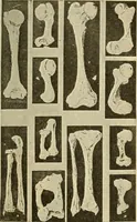 An illustration from The diseases of infancy and childhood : for the use of students and practitioners of medicine / by L. Emmett Holt with two hundred and forty-one illustrations, including eight coloured plates. (1908)