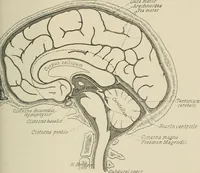 An illustration from Meningococcus meningitis / by Henry Heiman ... and Samuel Feldstein ... with introduction by Henry Koplik ... with 4 plates, 31 figures, 2 in color, and 4 charts. (1913)