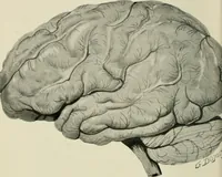 An illustration from Meningococcus meningitis / by Henry Heiman ... and Samuel Feldstein ... with introduction by Henry Koplik ... with 4 plates, 31 figures, 2 in color, and 4 charts. (1913)