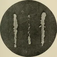 An illustration from Meningococcus meningitis / by Henry Heiman ... and Samuel Feldstein ... with introduction by Henry Koplik ... with 4 plates, 31 figures, 2 in color, and 4 charts. (1913)