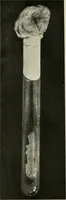 Picture 3 of 23 from Meningococcus meningitis / by Henry Heiman ... and Samuel Feldstein ... with introduction by Henry Koplik ... with 4 plates, 31 figures, 2 in color, and 4 charts. (1913), leaf 44