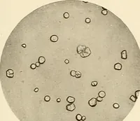 An illustration from A manual of practical hygiene for students, physicians, and health officers / By Charles Harrington. (1914)