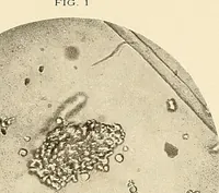 An illustration from A manual of practical hygiene for students, physicians, and health officers / By Charles Harrington. (1914)