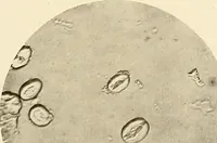 An illustration from A manual of practical hygiene for students, physicians, and health officers / By Charles Harrington. (1914)