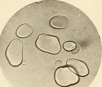 An illustration from A manual of practical hygiene for students, physicians, and health officers / By Charles Harrington. (1914)
