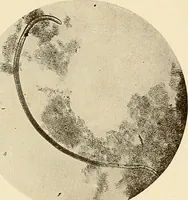 An illustration from A manual of practical hygiene for students, physicians, and health officers / By Charles Harrington. (1914)