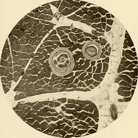 An illustration from A manual of practical hygiene for students, physicians, and health officers / By Charles Harrington. (1914)