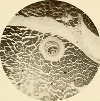 An illustration from A manual of practical hygiene for students, physicians, and health officers / By Charles Harrington. (1914)