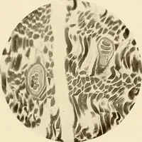 An illustration from A manual of practical hygiene for students, physicians, and health officers / By Charles Harrington. (1914)