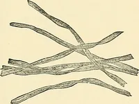 An illustration from A manual of practical hygiene for students, physicians, and health officers / By Charles Harrington. (1914)