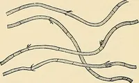 An illustration from A manual of practical hygiene for students, physicians, and health officers / By Charles Harrington. (1914)
