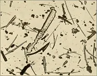 An illustration from A manual of practical hygiene for students, physicians, and health officers / By Charles Harrington. (1914)