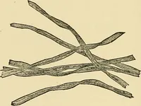 Picture 105 of 111 from A manual of practical hygiene for students, physicians, and medical officers / by Charles Harrington. (1905), leaf 744