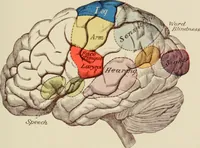 An illustration from Practical diagnosis: the use of symptoms in the diagnosis of disease / By Hobart Amory Hare ... Illustrated with 191 engravings and 13 colored plates. (1896)