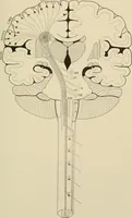 An illustration from Practical diagnosis: the use of symptoms in the diagnosis of disease / By Hobart Amory Hare ... Illustrated with 191 engravings and 13 colored plates. (1896)