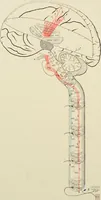 An illustration from Practical diagnosis: the use of symptoms in the diagnosis of disease / By Hobart Amory Hare ... Illustrated with 191 engravings and 13 colored plates. (1896)