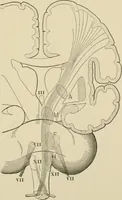 An illustration from Practical diagnosis: the use of symptoms in the diagnosis of disease / By Hobart Amory Hare ... Illustrated with 191 engravings and 13 colored plates. (1896)