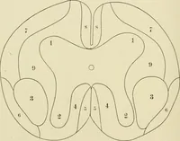 An illustration from Practical diagnosis: the use of symptoms in the diagnosis of disease / By Hobart Amory Hare ... Illustrated with 191 engravings and 13 colored plates. (1896)