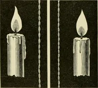 An illustration from Practical diagnosis: the use of symptoms in the diagnosis of disease / By Hobart Amory Hare ... Illustrated with 191 engravings and 13 colored plates. (1896)