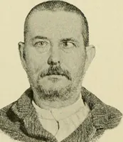 An illustration from Practical diagnosis: the use of symptoms in the diagnosis of disease / By Hobart Amory Hare ... Illustrated with 191 engravings and 13 colored plates. (1896)