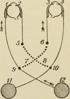 An illustration from Practical diagnosis: the use of symptoms in the diagnosis of disease / By Hobart Amory Hare ... Illustrated with 191 engravings and 13 colored plates. (1896)