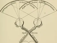 An illustration from Practical diagnosis: the use of symptoms in the diagnosis of disease / By Hobart Amory Hare ... Illustrated with 191 engravings and 13 colored plates. (1896)