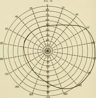An illustration from Practical diagnosis: the use of symptoms in the diagnosis of disease / By Hobart Amory Hare ... Illustrated with 191 engravings and 13 colored plates. (1896)