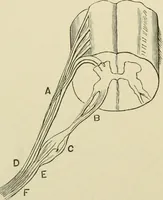 An illustration from Practical diagnosis: the use of symptoms in the diagnosis of disease / By Hobart Amory Hare ... Illustrated with 191 engravings and 13 colored plates. (1896)