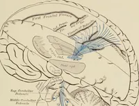 An illustration from Practical diagnosis: the use of symptoms in the diagnosis of disease / By Hobart Amory Hare ... Illustrated with 191 engravings and 13 colored plates. (1896)