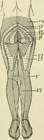 An illustration from Practical diagnosis: the use of symptoms in the diagnosis of disease / By Hobart Amory Hare ... Illustrated with 191 engravings and 13 colored plates. (1896)