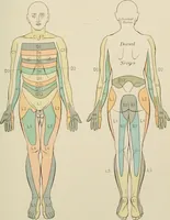 An illustration from Practical diagnosis: the use of symptoms in the diagnosis of disease / By Hobart Amory Hare ... Illustrated with 191 engravings and 13 colored plates. (1896)
