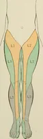 An illustration from Practical diagnosis: the use of symptoms in the diagnosis of disease / By Hobart Amory Hare ... Illustrated with 191 engravings and 13 colored plates. (1896)