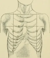 An illustration from Practical diagnosis: the use of symptoms in the diagnosis of disease / By Hobart Amory Hare ... Illustrated with 191 engravings and 13 colored plates. (1896)