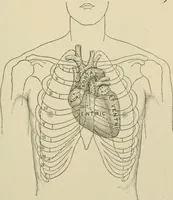 An illustration from Practical diagnosis: the use of symptoms in the diagnosis of disease / By Hobart Amory Hare ... Illustrated with 191 engravings and 13 colored plates. (1896)