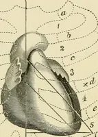 An illustration from Practical diagnosis: the use of symptoms in the diagnosis of disease / By Hobart Amory Hare ... Illustrated with 191 engravings and 13 colored plates. (1896)