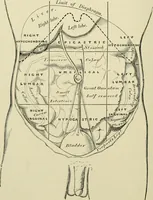 An illustration from Practical diagnosis: the use of symptoms in the diagnosis of disease / By Hobart Amory Hare ... Illustrated with 191 engravings and 13 colored plates. (1896)