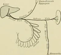 An illustration from Practical diagnosis: the use of symptoms in the diagnosis of disease / By Hobart Amory Hare ... Illustrated with 191 engravings and 13 colored plates. (1896)