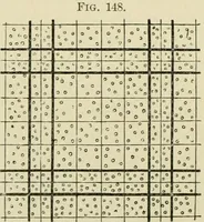 An illustration from Practical diagnosis: the use of symptoms in the diagnosis of disease / By Hobart Amory Hare ... Illustrated with 191 engravings and 13 colored plates. (1896)