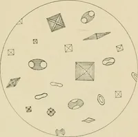 An illustration from Practical diagnosis: the use of symptoms in the diagnosis of disease / By Hobart Amory Hare ... Illustrated with 191 engravings and 13 colored plates. (1896)