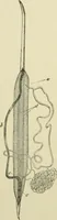 An illustration from Practical diagnosis: the use of symptoms in the diagnosis of disease / By Hobart Amory Hare ... Illustrated with 191 engravings and 13 colored plates. (1896)