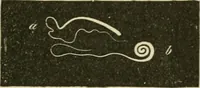 An illustration from Practical diagnosis: the use of symptoms in the diagnosis of disease / By Hobart Amory Hare ... Illustrated with 191 engravings and 13 colored plates. (1896)