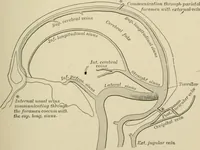 An illustration from Practical diagnosis: the use of symptoms in the diagnosis of disease / By Hobart Amory Hare ... Illustrated with 191 engravings and 13 colored plates. (1896)