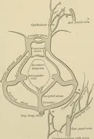 An illustration from Practical diagnosis: the use of symptoms in the diagnosis of disease / By Hobart Amory Hare ... Illustrated with 191 engravings and 13 colored plates. (1896)