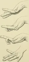 An illustration from Practical diagnosis: the use of symptoms in the diagnosis of disease / By Hobart Amory Hare ... Illustrated with 191 engravings and 13 colored plates. (1896)