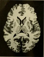 An illustration from Handbook of physiology : for students and practitioners of medicine / by Austin Flint ... with two hundred and forty-seven illustrations in the text--including four in colors--and an atlas of sixteen color-plates, including forty-eight original figures taken from actual stained microscopical preparation. (1905)