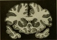 Picture 121 of 214 from Handbook of physiology : for students and practitioners of medicine / by Austin Flint ... with two hundred and forty-seven illustrations in the text--including four in colors--and an atlas of sixteen color-plates, including forty-eight original figures taken from actual stained microscopical preparation. (1905), leaf 614